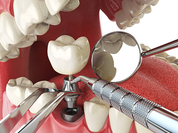 Best Emergency Gum Treatment in Mitchell, SD